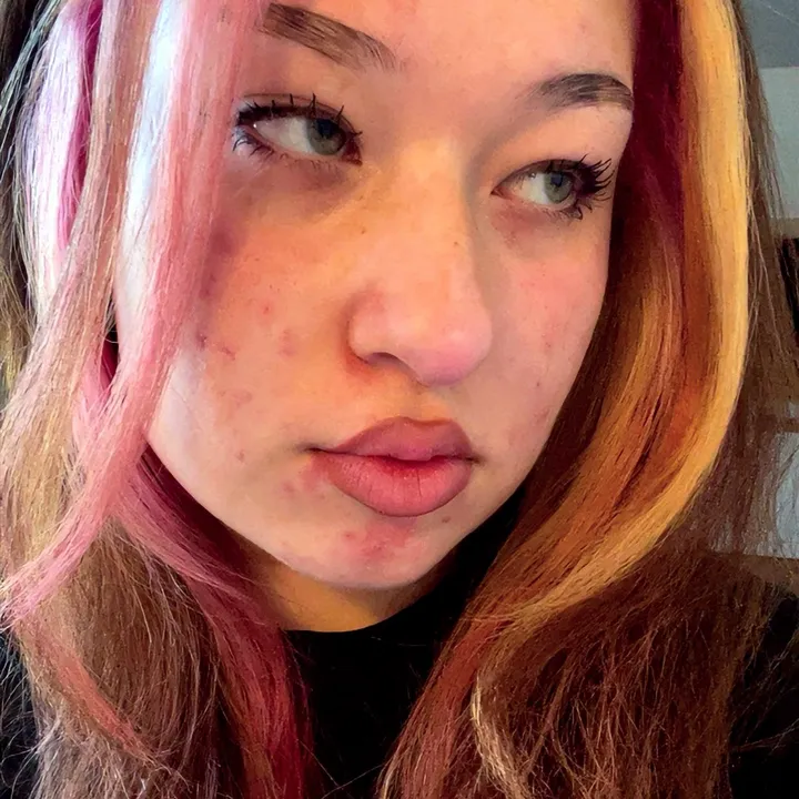 auroraxlc