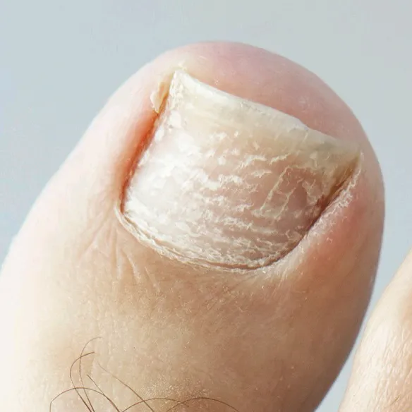 toenails.clips