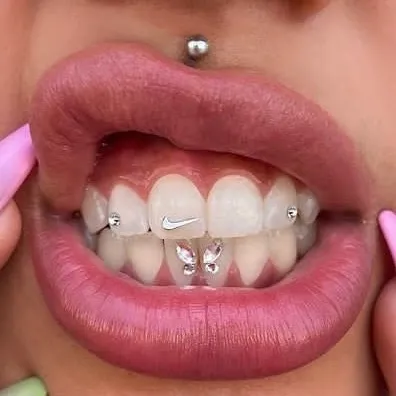 zahnschmuck_