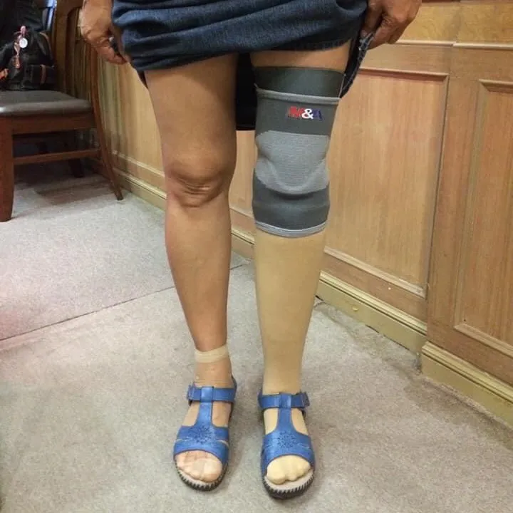 prostheticthai